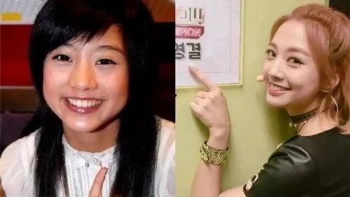 盘点娱乐圈明星整容前后